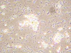 EM-1 Bacteria cells